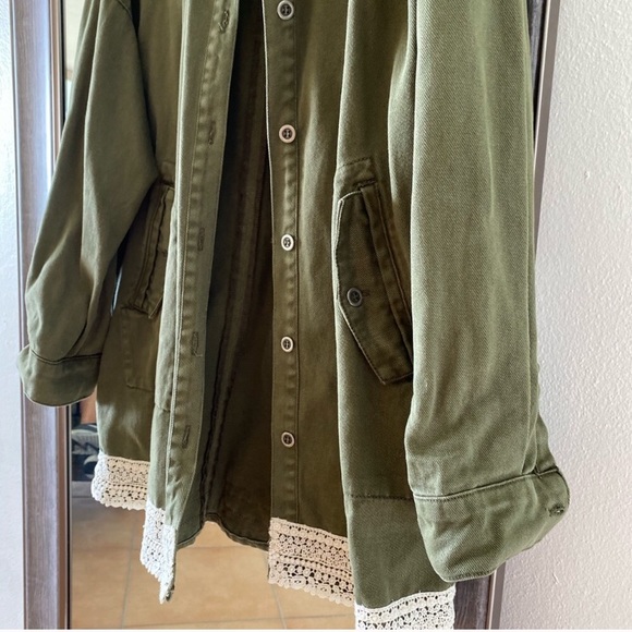 Zara Mixed Lace Overshirt - Picture 8 of 9